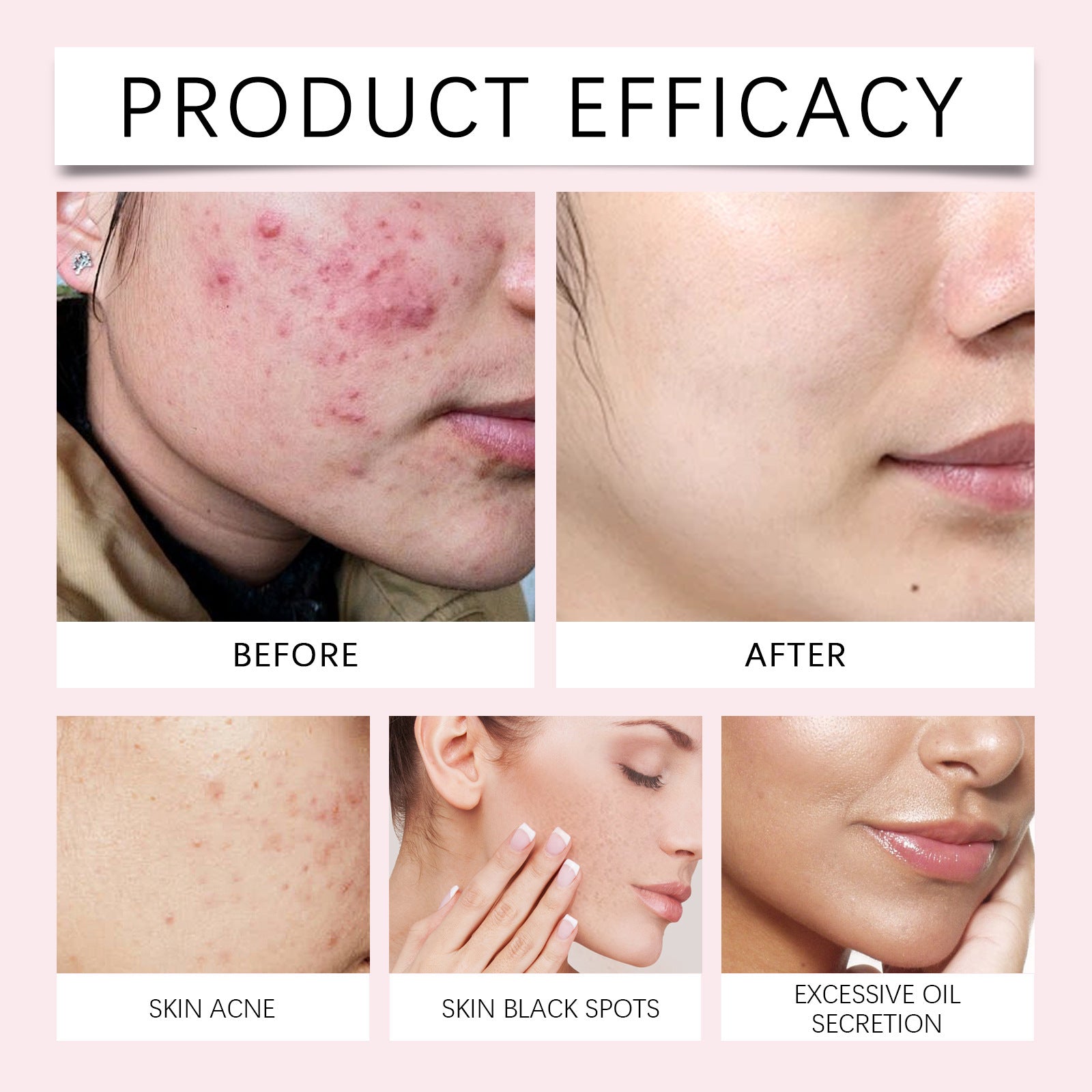 EELHOE Turmeric Kojic Acid Cleansing Pad Gentle Cleansing Skin Care Fades Acne Facial Brightening And Tender Pores